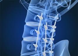 Neurosurgery