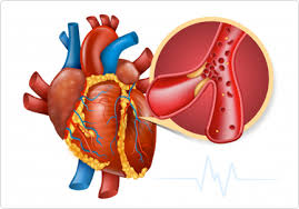 criticalcare